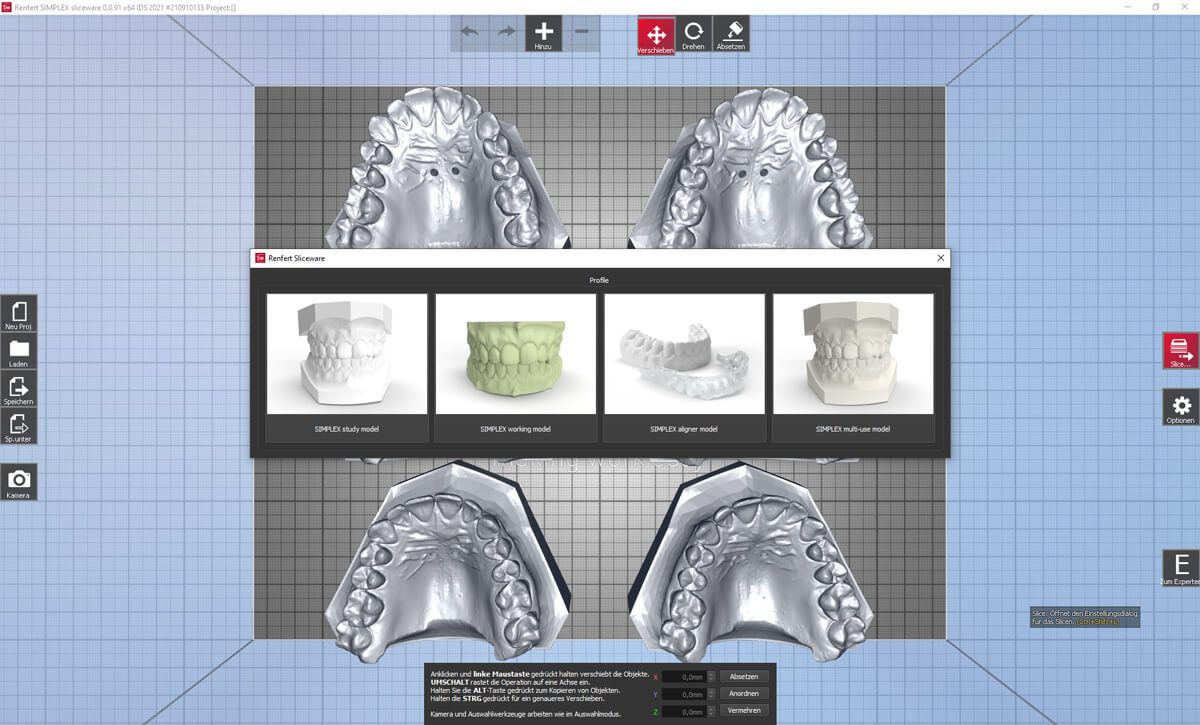 FORESTADENT - Digital Products - Simplex Filament Printer - Slice Software